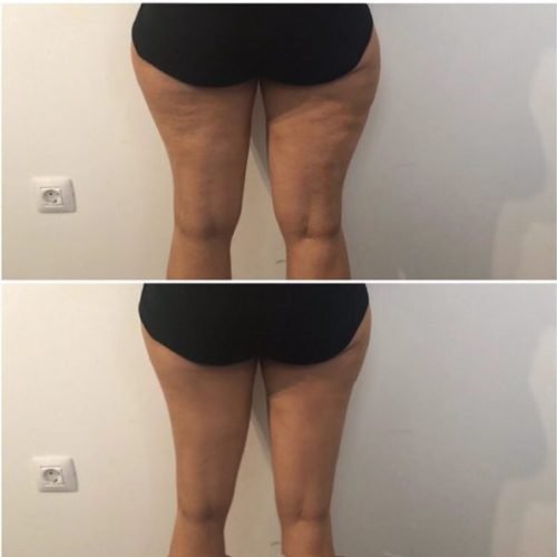 MED-CONTOUR-min-1-600x595