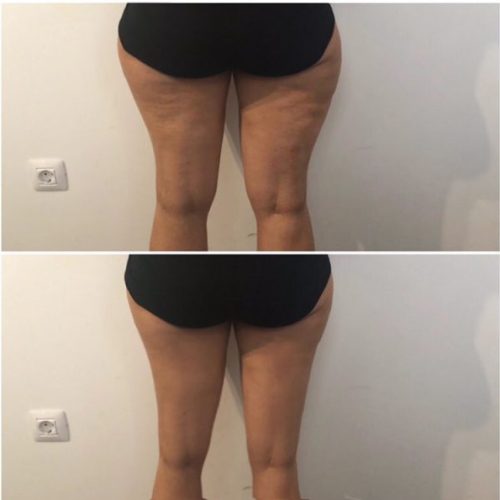 MED-CONTOUR-min-1-600x595