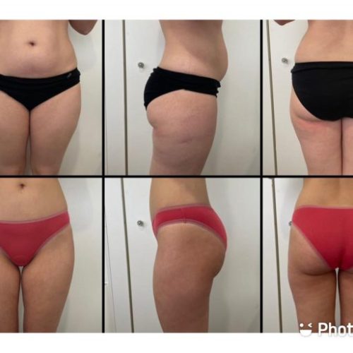 MED-CONTOUR-min-768x513